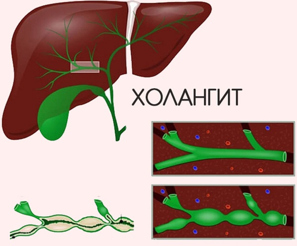Урсофальк суспензия для новорожденных. Инструкция по применению, аналоги
