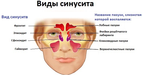 ТераФлю (TeraFlu). Цена 1 пакетика, инструкция по применению, аналоги дешевле