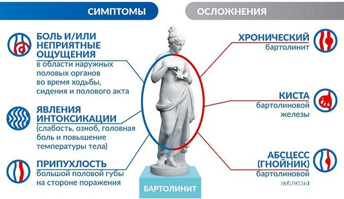 Воспаления по-женски придатков, почек, яичников, мочевого пузыря, лимфоузлов в паху, симптомы и лечение