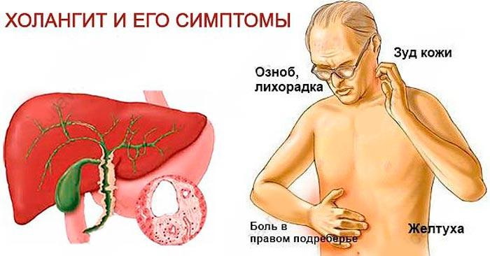 Заболевания печени и желчного пузыря. Симптомы, лечение