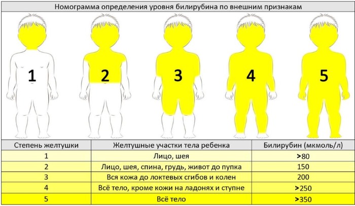 Желтушка у новорожденных. Причины и последствия, норма билирубина, лечение, чем опасна, сколько длится, когда проходит